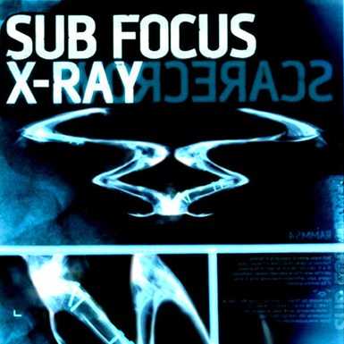 X Ray Ringtone Download Free X Ray Ringtone Download Free