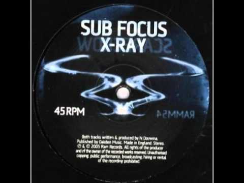 X-Ray Ringtone Download Free X-Ray Ringtone Download Free